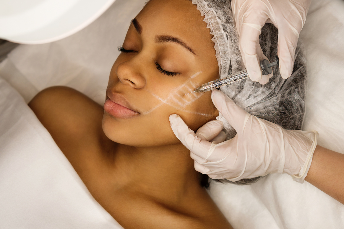 Aesthetic corrective treatments. Filler injections